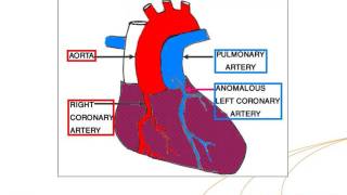 IAEAESNM Webinar  Myocardial Perfusion Scintigraphy in Paediatric Cardiology [upl. by Jolyn]