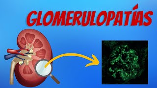 Glomerulopatías Explicadas Claramente [upl. by Eirahcaz]