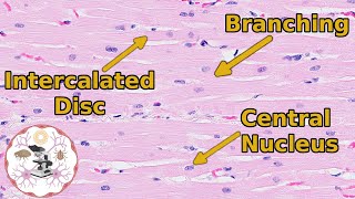 Heart Histology  Valveuable Insights [upl. by Mellar]