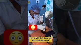 Do ka sikha kaise nikale gale se shortsfeed nursingstudentlife  ytshortsyoutubeshorts [upl. by Lamak]