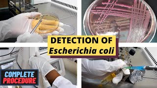 Coliform Bacteria Test Kit  How to Test For Coliform Bacteria in Water 2019 [upl. by Erde]