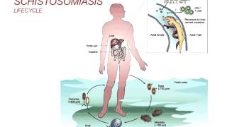 Webinar Schistosomiasis  Diagnosis and Treatment 2014 [upl. by Eisak]