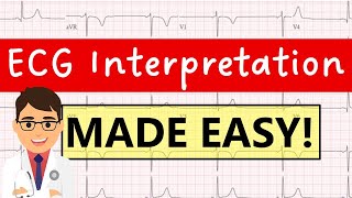 How to interpret an ECG systematically  EXPLAINED CLEARLY [upl. by Ronni]