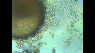 Under The Microscope Ep6  Mold Spore Time Lapse [upl. by Ahseele]