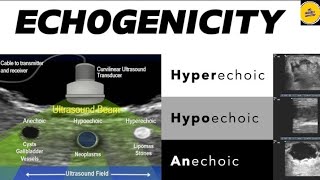 Explain Echogenicity  hyperechoic hypoechoic anechoic [upl. by Urian]