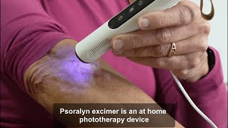 Psoralyn Excimer  Psoriasis Treatment with the power of natural UVB light [upl. by Krell]