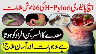 H Pylori Infection Urdu Hindi  H Pylori Treatment  Stomach Ulcer Treatment  Urdu Lab [upl. by Blatman]