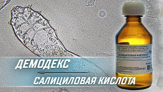 Как салициловая кислота убивает клеща Demodex [upl. by Llerrehc]