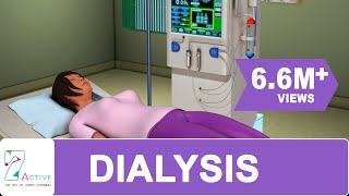 Procedure of DIALYSIS [upl. by Aynwad]