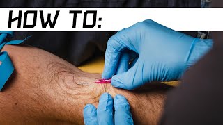 How to Start an IV  Live Demo [upl. by Noizneb741]