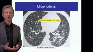 ECN PID cours 1 DFASM1 Diagnostic des PID Pr V Cottin Lyon [upl. by Joscelin]