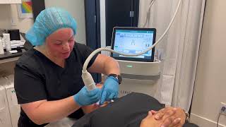 Potenza RF Microneedling at Nouveau MedSpas [upl. by Nilrak]