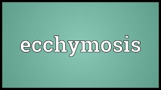 Ecchymosis Meaning [upl. by Atolrac]