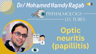 Neuro 2 Optic neuritis papillitis [upl. by Ariaz]