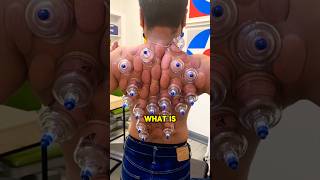 This is an extremely strange procedure 😲viral satisfying weird shorts [upl. by Nosnah]