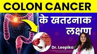 Colon Cancer Kya Hai Kyu Hota Hai Causes amp Symptoms of Colon Cancer in Detail [upl. by Allbee]