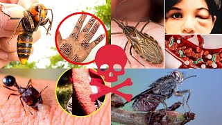 Los 5 insectos más peligros del mundo 2024 [upl. by Etteneg]