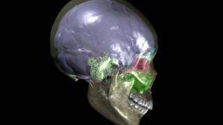 Human skull with brain endocast paranasal sinuses amp mastoid sinuses [upl. by Iur]