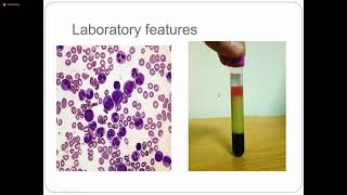 Myeloproliferative Disorders  3rd Year  Hematology Module  Pathology [upl. by Eardnoed]