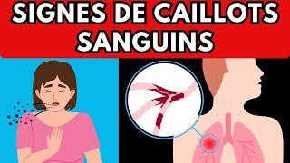 9 Signes DALERTE de CAILLOTS SANGUINS à Connaître  Santé Intégrale [upl. by Alvar117]