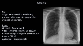 How to Interpret a Chest XRay Lesson 10  Self Assessment Part 2 [upl. by Philan]