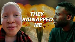 Deadly hunt Albinos in Uganda [upl. by Allegra]