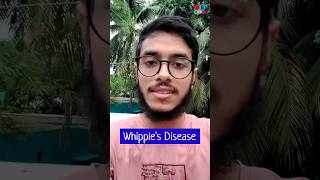 Whipples disease  Malabsorption syndrome  Pathology Medicine Surgery  Dr Med [upl. by Agrippina4]