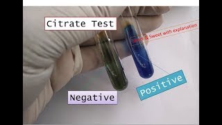 Citrate Utilization test positiveCitrate testCitrate positive bacteria in microbiology practical [upl. by Gnues]