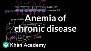 Anemia of chronic disease  Hematologic System Diseases  NCLEXRN  Khan Academy [upl. by Elyse]