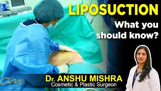 ✅ Best Liposuction Surgery in Dubai Types Fast Recovery Tips And Care After Surgery [upl. by Secor]