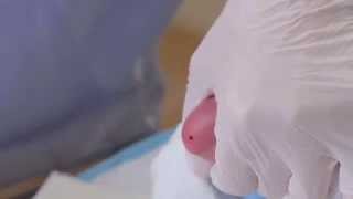 CLSI Newborn Screening DVD  Informational Video Trailer [upl. by Clement]