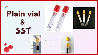 Plain tube  clot activator  Blood collection tubes  vacutainer [upl. by Eenafets289]