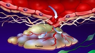 Introduction to Cancer Biology Part 4 Angiogenesis [upl. by Narton29]