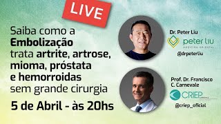 SAIBA COMO EMBOLIZAÇÃO TRATA ARTRITE MIOMA HEMORROIDA E PROSTATA SEM GRANDE CIRURGIA [upl. by Ailen]