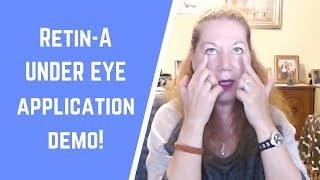 How to Apply RetinA Safely Under the Eye  Antiaging Demonstration [upl. by Lock]