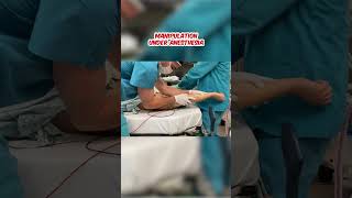 Manipulation Under Anaesthesia for frozen shoulder  Dr Jeya Venkatesh [upl. by Dis615]