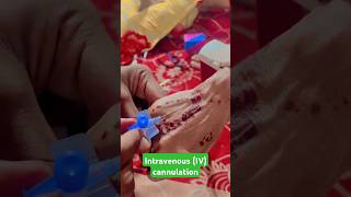 Intravenous IVcannulation । Cannulation Technique । Vgo kaise Lagaye ।। cannulation ivinjection [upl. by Federico]