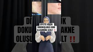 DİYETTE KÜÇÜK DOKUNUŞLARLA AKBE OLUŞUMUNU AZALT ‼️ diyetisyen diyet [upl. by Eanwahs]