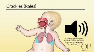 Respiratory Assessment by B Leary L DelSignore  OPENPediatrics [upl. by Nivanod]