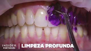 Limpeza Profissional de Dentes  Limpeza Profunda  Insider Português [upl. by Shauna245]