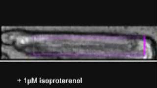 cardiac myocyte contractility [upl. by Naicad]