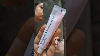 glocin gel review If you have any doubts of glocin gel check this clindamycin amp nicotinamide gel [upl. by Ehcsrop]