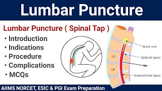 Lumbar Puncture Spinal Tap Procedure and MCQs [upl. by Reeves838]