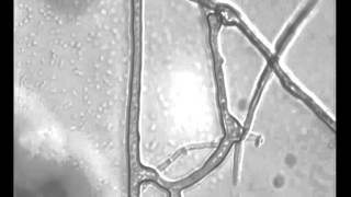 Anastomosis in mycorrhizal fungi [upl. by Kcirnek]