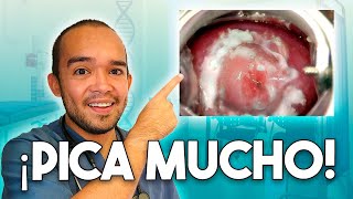 Cómo quitar el FLUJO GRUMOSO que PICA  CANDIDIASIS [upl. by Harts100]