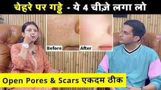 Open Pores And Scars Treatment Ftupasanakiduniya  Open Pores Home Remedy  Himanshu Bhatt [upl. by Kenleigh]