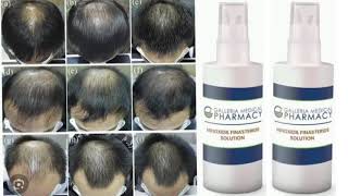 Minoxidil Finasteride Solution [upl. by Mitchael799]