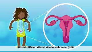 Is nonhormonal contraceptive better than a hormonal one Learn how It Works and What to Expect [upl. by Andrus236]