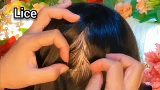 ASMR Satisfying I will help remove your fleas  No Talking 😴💤🥱 [upl. by Fasta]