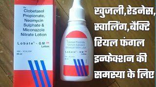 Lobate gm lotion usde amp sideffecte lobate GM neo lotion full review in Hindi lobate gm Lotion [upl. by Hey]